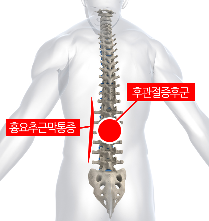 허리 부위별 통증의 원인 : 네이버 포스트