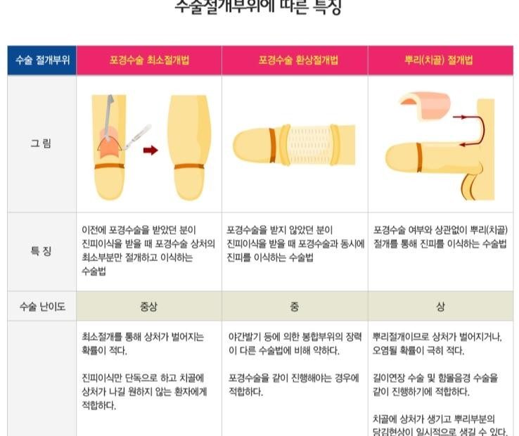 쿨맨 일산 남성 비뇨기과