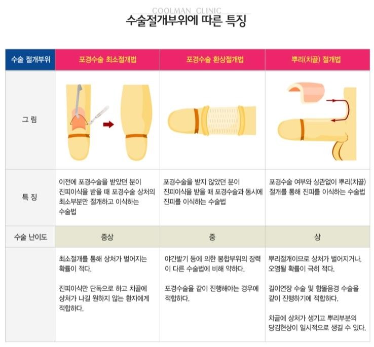 쿨맨 일산 남성 비뇨기과