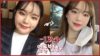 60Kg ‣ 47Kg ✨ -13Kg 얼굴변화 / 얼굴 살, 붓기 빼는 방법 / 얼굴에 받은 시술 총 정리! - Youtube