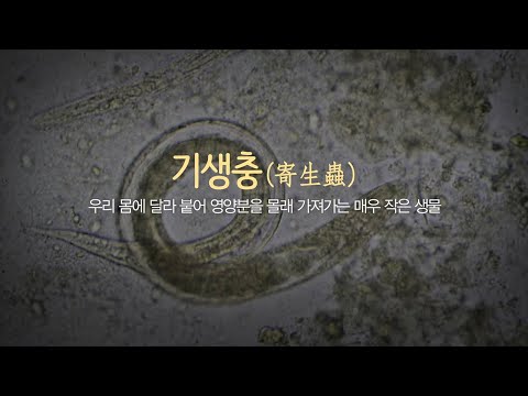 우리 몸 속, 아직도 기생충이? [건강플러스]