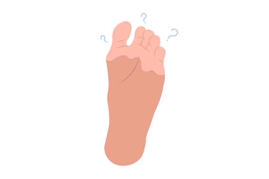 Numbness In Toes | 9 Reasons Your Toes Are Numb | Buoy