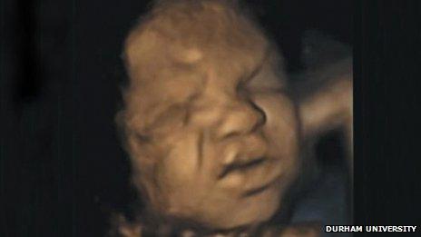 Babies Practise Crying In The Womb, Durham Researchers Claim - Bbc News