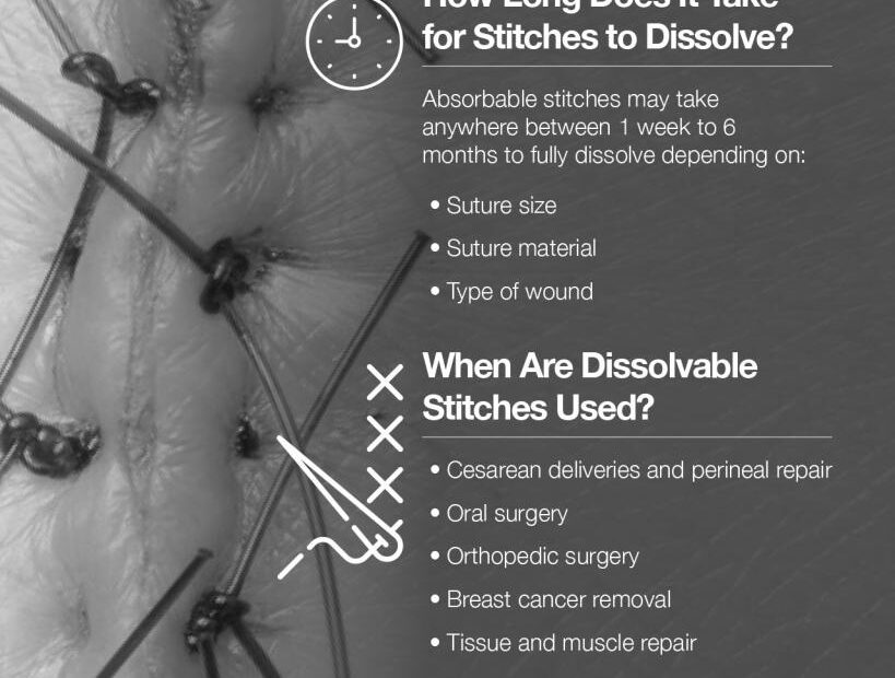 24 How Long Does It Take For Dissolvable Stitches To Dissolve Full Guide  (9/2023)