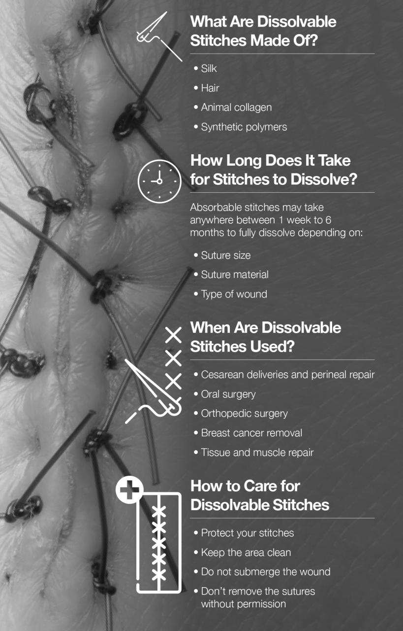 24 How Long Does It Take For Dissolvable Stitches To Dissolve Full Guide  (9/2023)