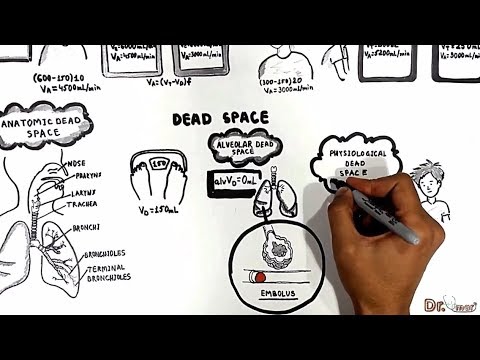 Dead Spaces (Anatomic, Physiologic, alveolar)