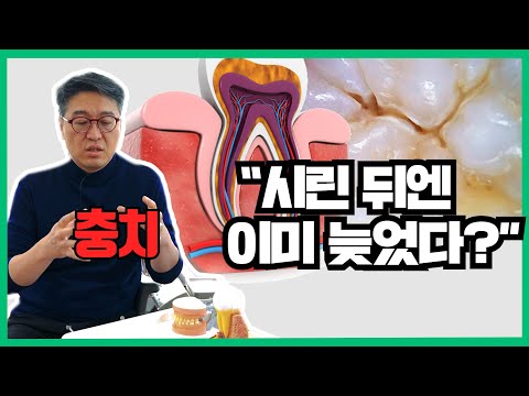 치과마다 충치 개수 다르게 알려주는 이유 / 신경치료 받기 싫으면 미리미리 가자😁 - [올쏘의 아싸  시즌1_Ep6]