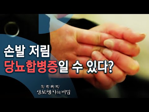 손발 저림, 당뇨합병증일 수 있다?_당독성이란 무엇인가 - 겨울철, 손발 저림 주의보 (KBS_761회_20210120)